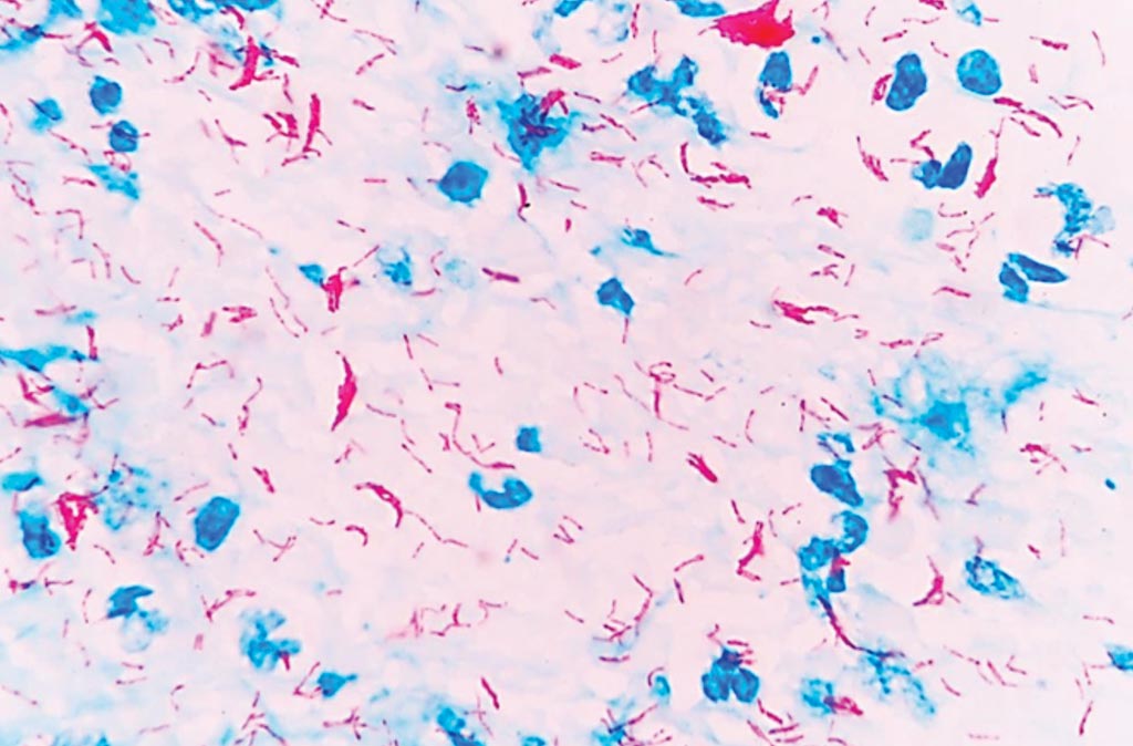 AFB under electronic microscope